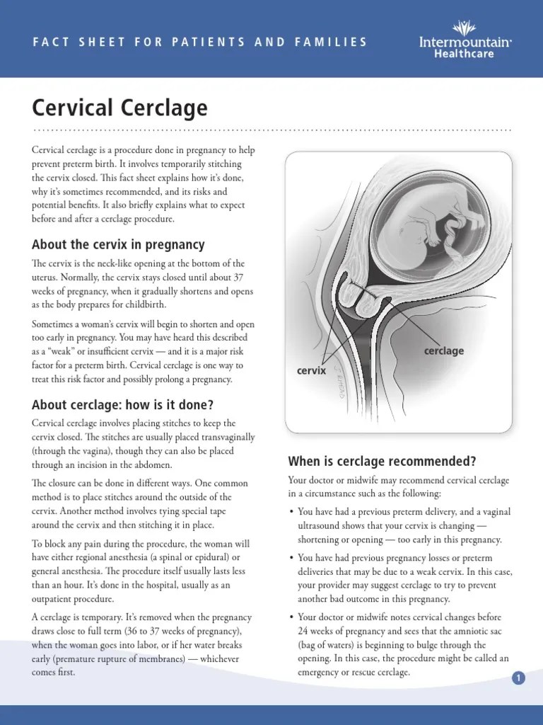 Cervical Cerclage Preterm Birth Childbirth