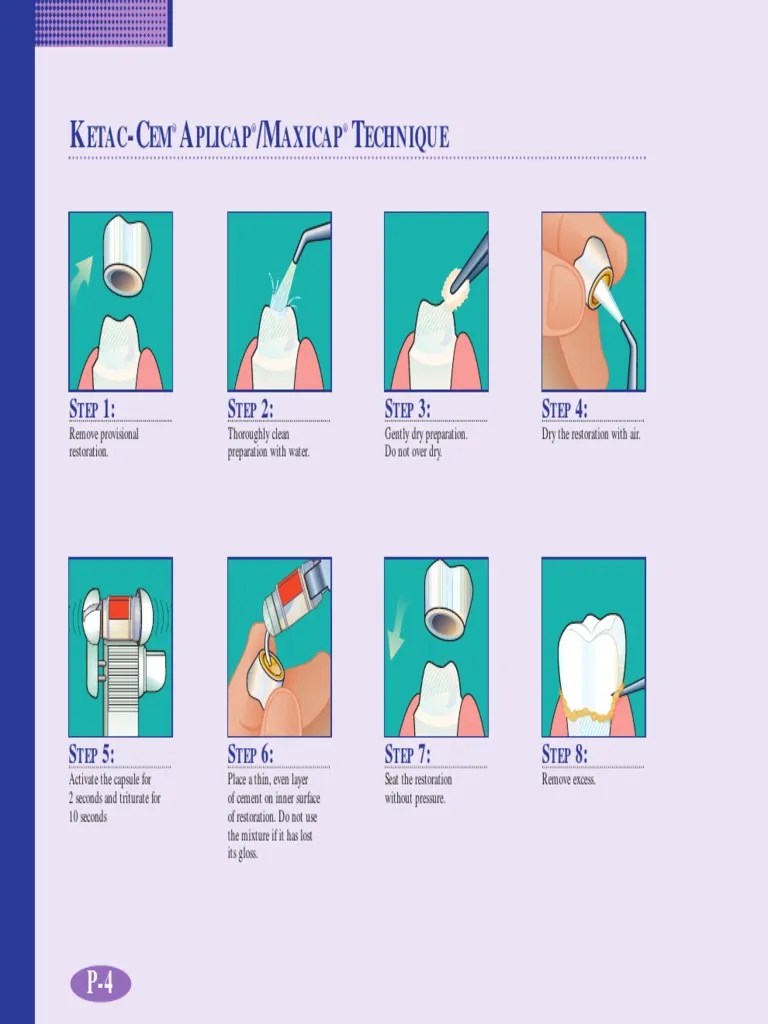 Ketac Cem Aplicap PDF Industrial Processes Industries