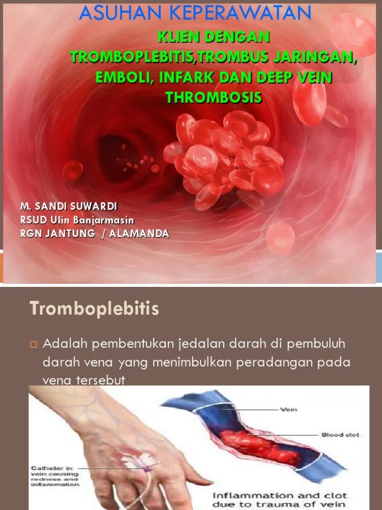 Askep Trombosis Vena Dalam(DVT).ppt