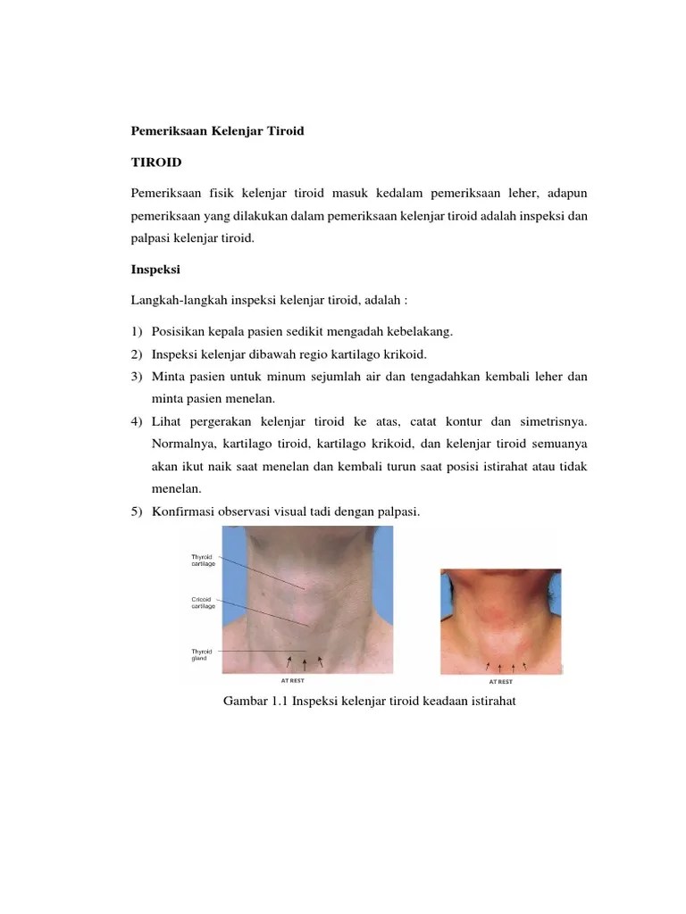 Pemeriksaan Kelenjar Tiroid