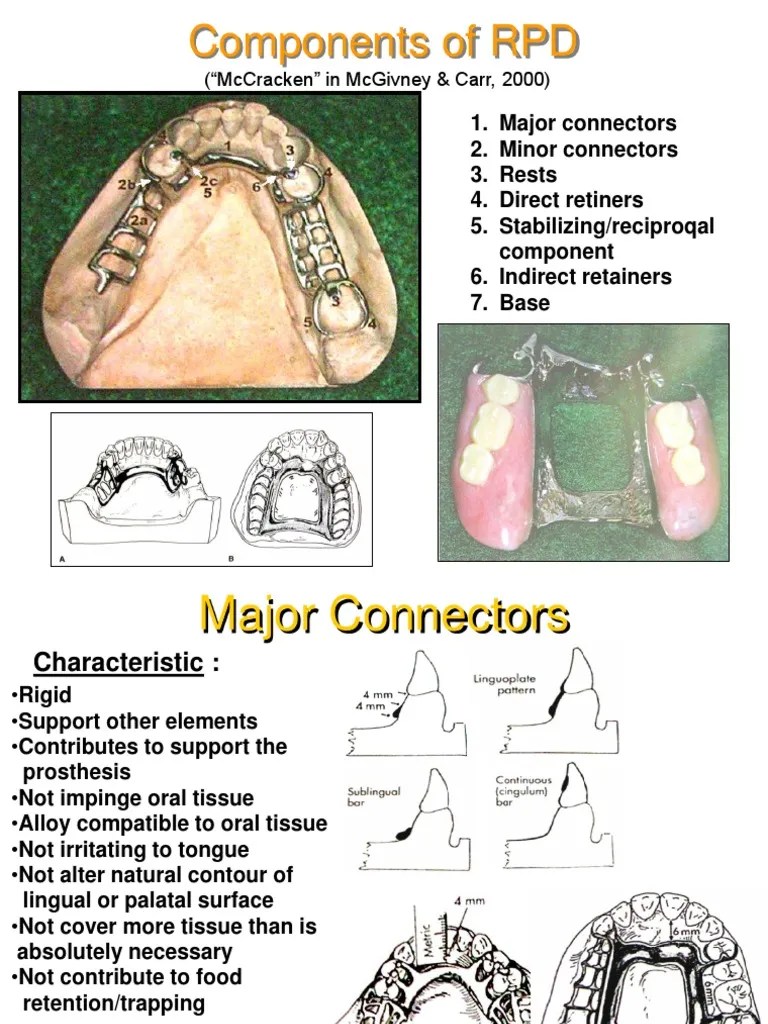 2 Components of RPD PDF Dentures Mouth