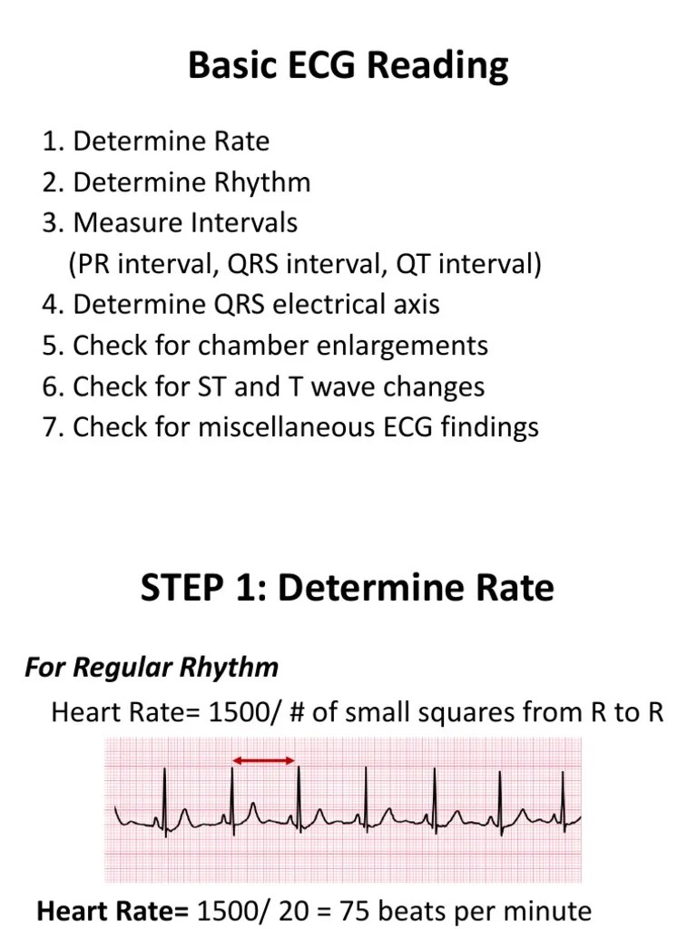 Basic ECG Reading Electrocardiography Heart Rate