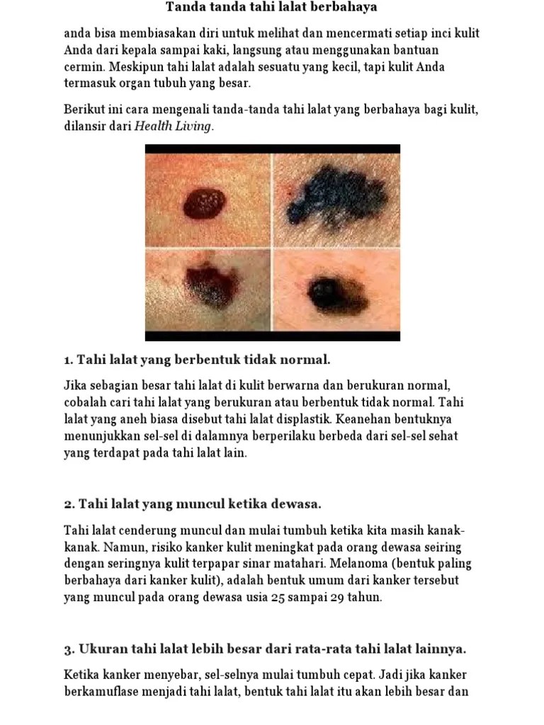 Pinakamabilis Tahi Lalat Normal