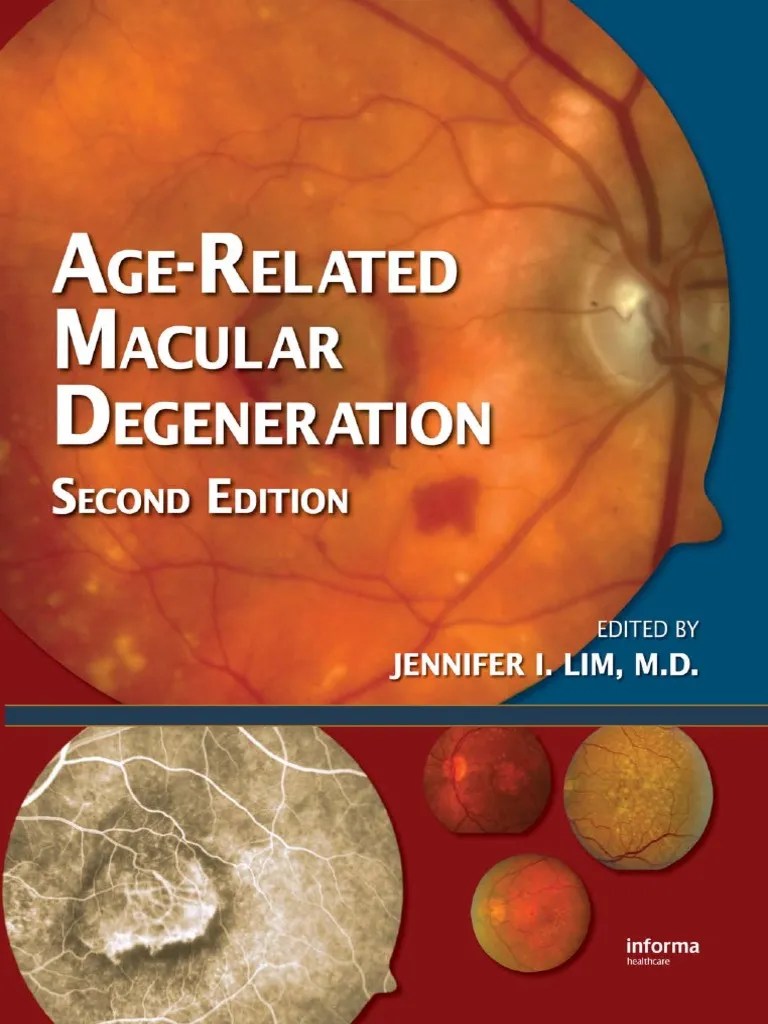 AgeRelated Macular Degeneration Medicine Medical Specialties