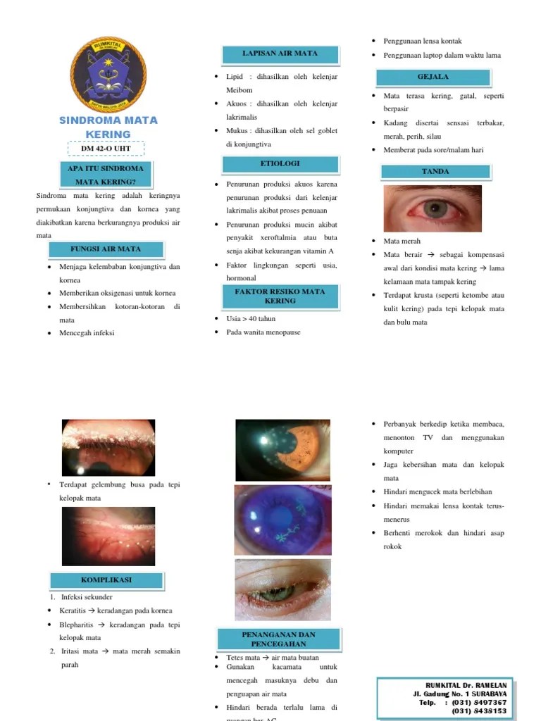 Leaflet Sindroma Mata Kering PDF