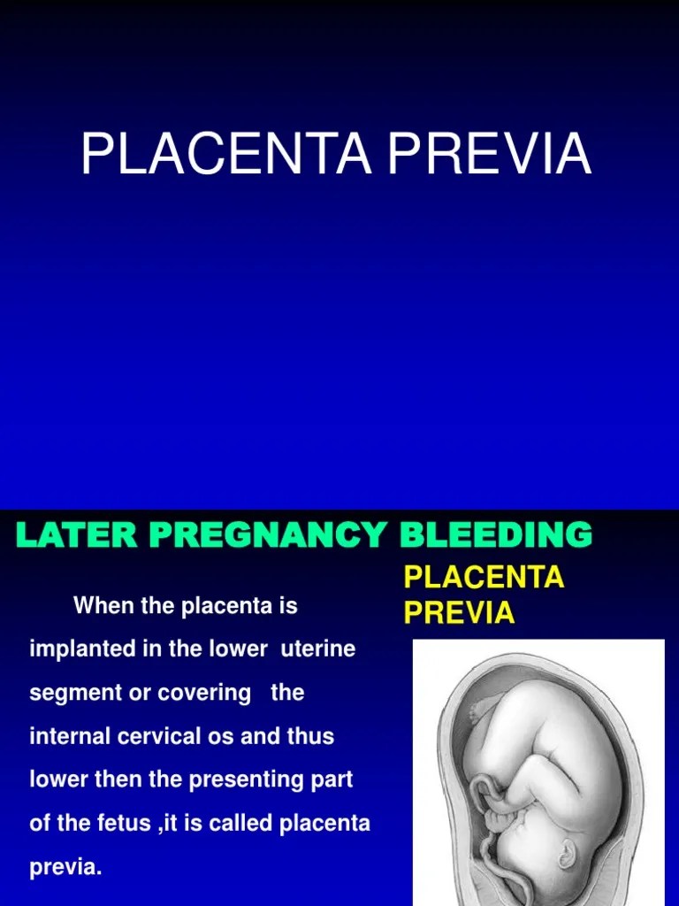 Placenta Previa and Placental Abruption Placenta Childbirth Free