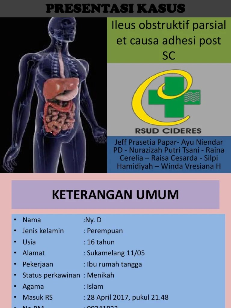 Lapsus - Ileus Obstruktif, Adhesi, Abses Intraabdomen Raina | PDF