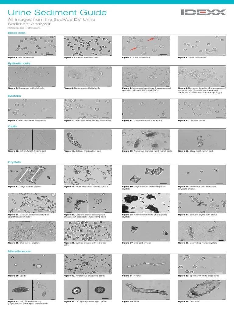 Sedivue Urine Sediment Guide Medical Specialties Earth & Life