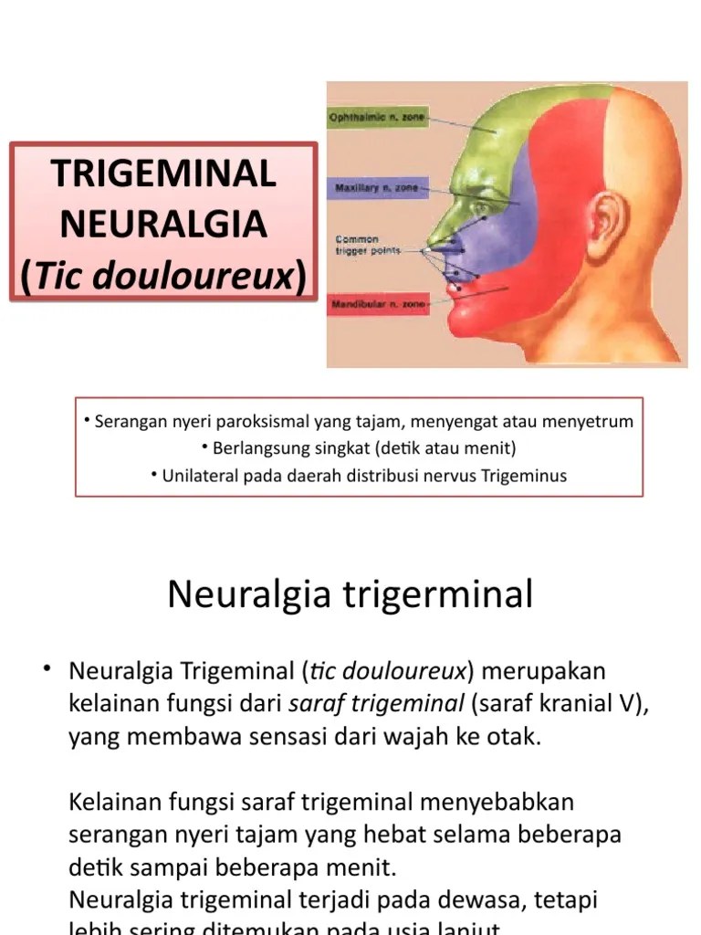 Trigeminal Neuralgia | PDF