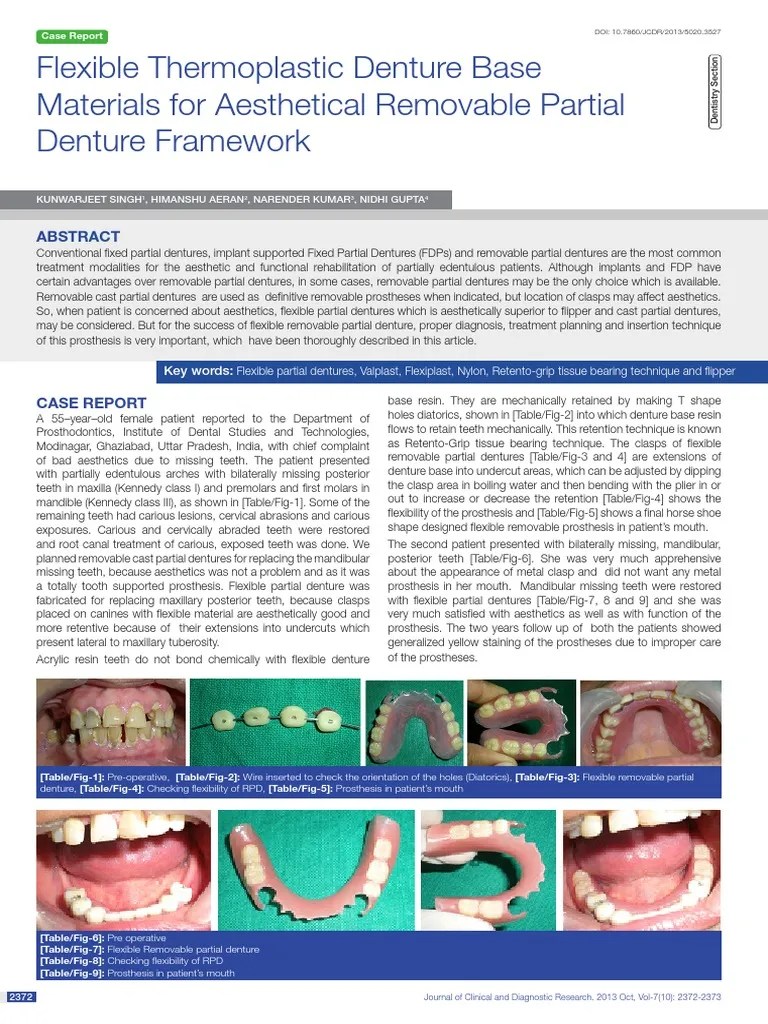 Flexible Thermoplastic Denture Base PDF PDF Dentures Mouth