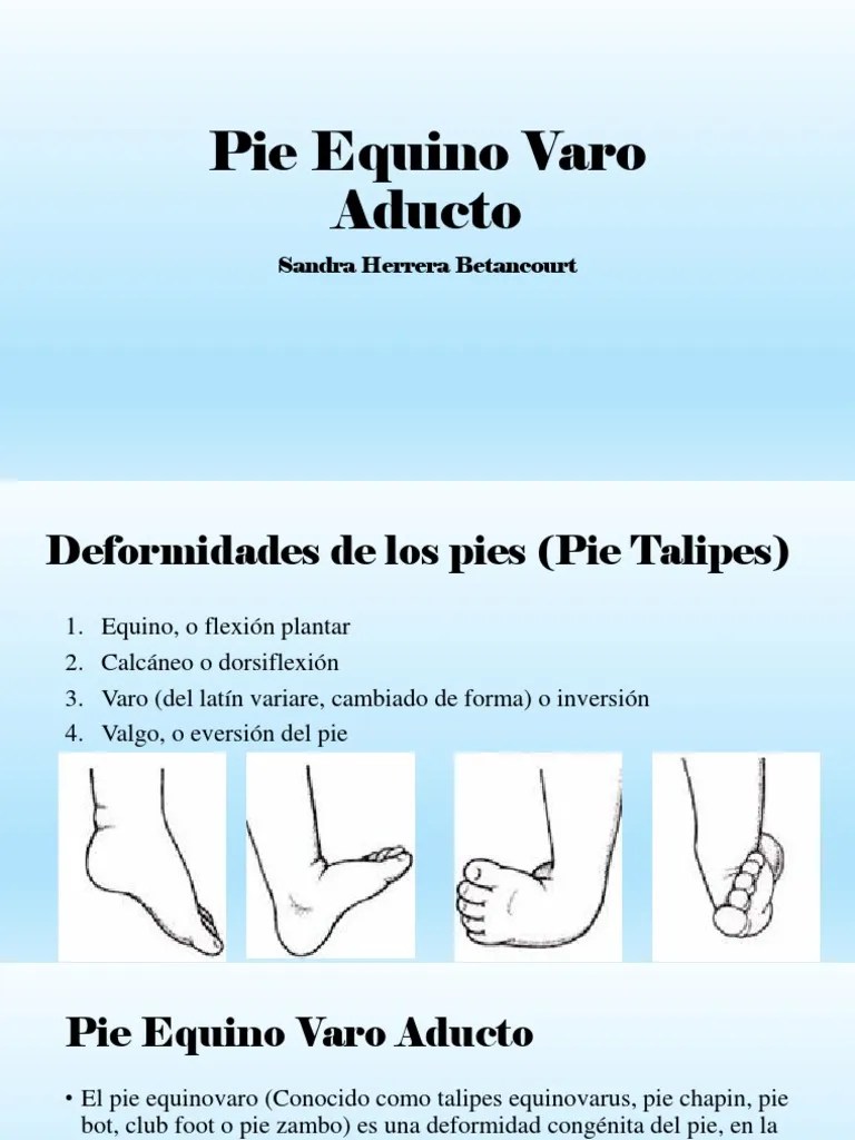 Pie Equino Varo Aducto PDF Pie Anatomía