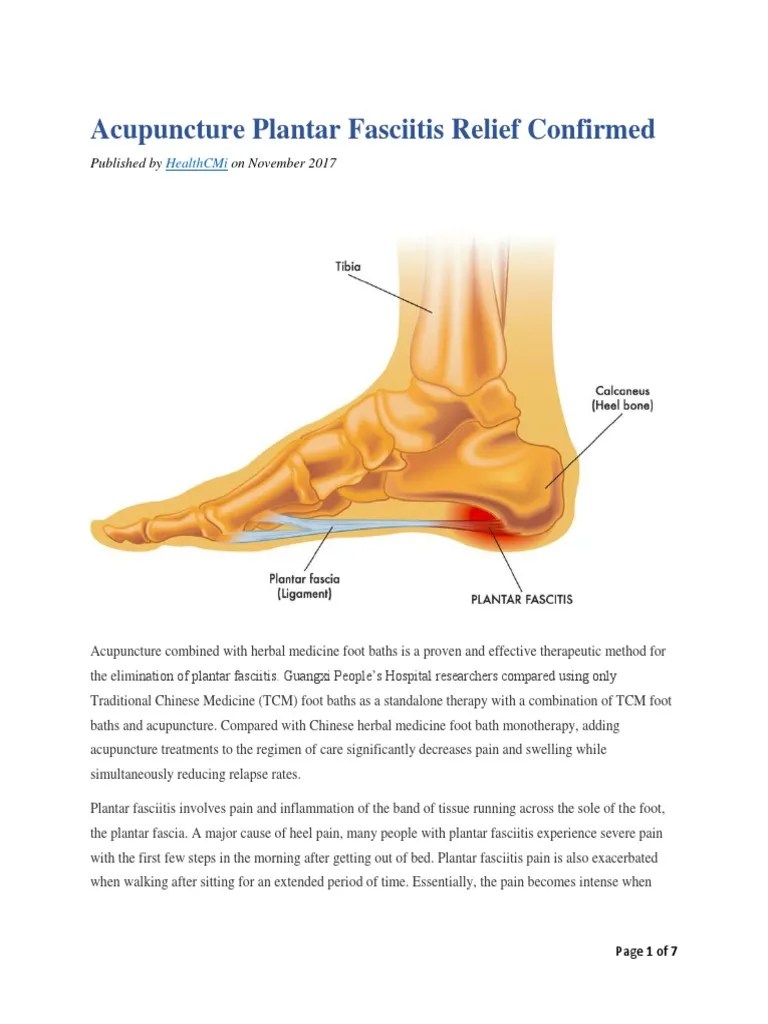 Acupuncture Plantar Fasciitis Relief Confirmed PDF Acupuncture