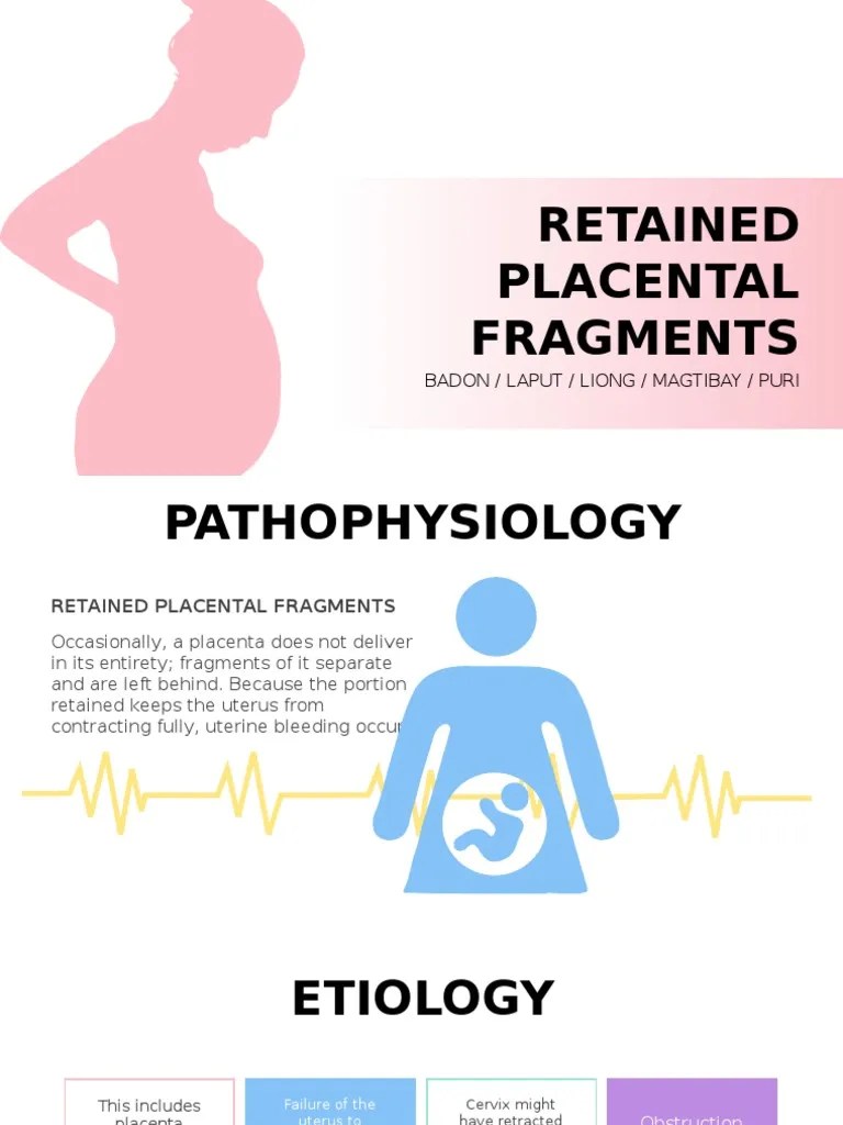 Retained Placental Fragments PDF Uterus Childbirth