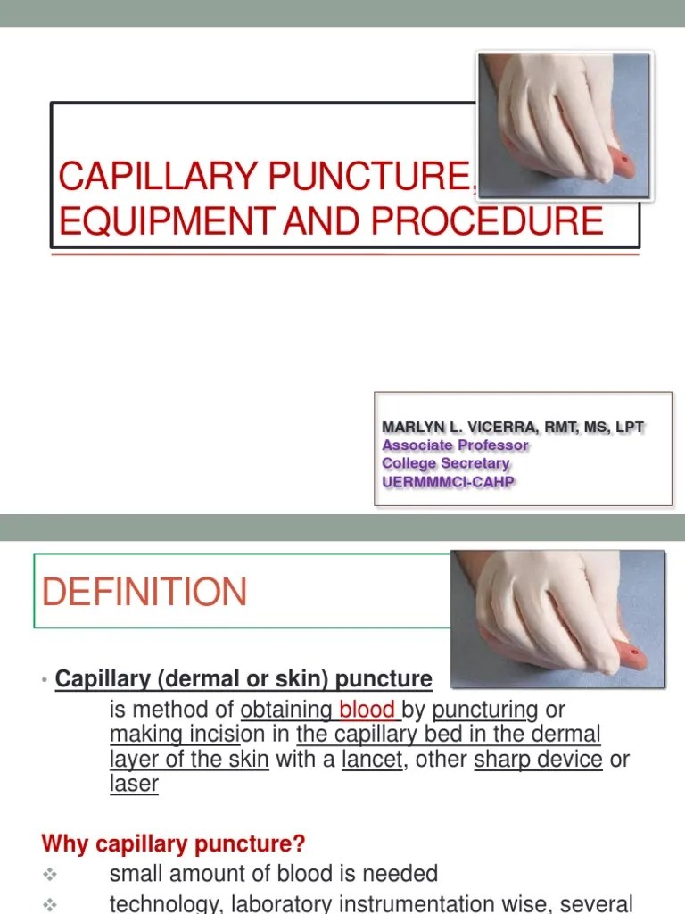 Capillary Puncture Equipment and Procedure PDF PDF Medical