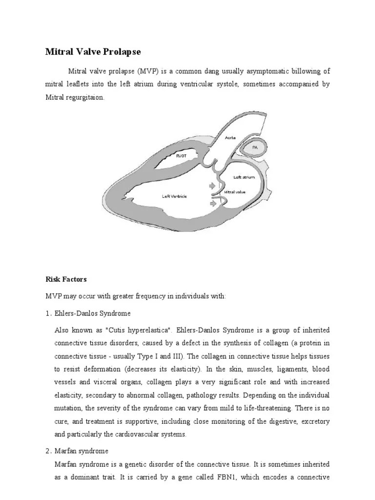 Mitral Valve Prolapse | Cardiovascular Diseases | Cardiology