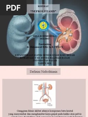 NEFROLITIASIS | PDF