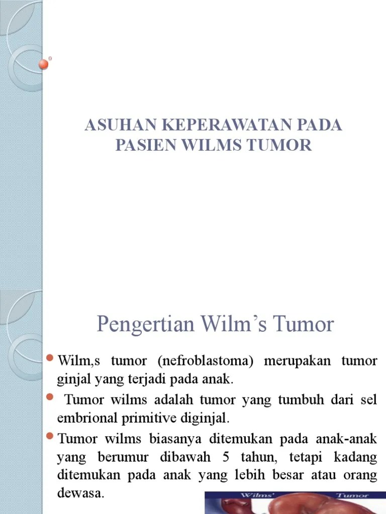 Wilms Tumor | PDF