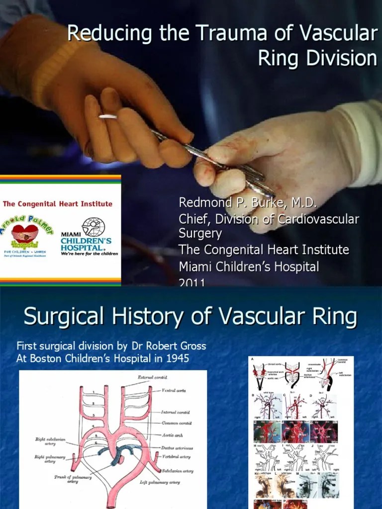 Vascular Ring Division 2011 PDF Medicine Health Care