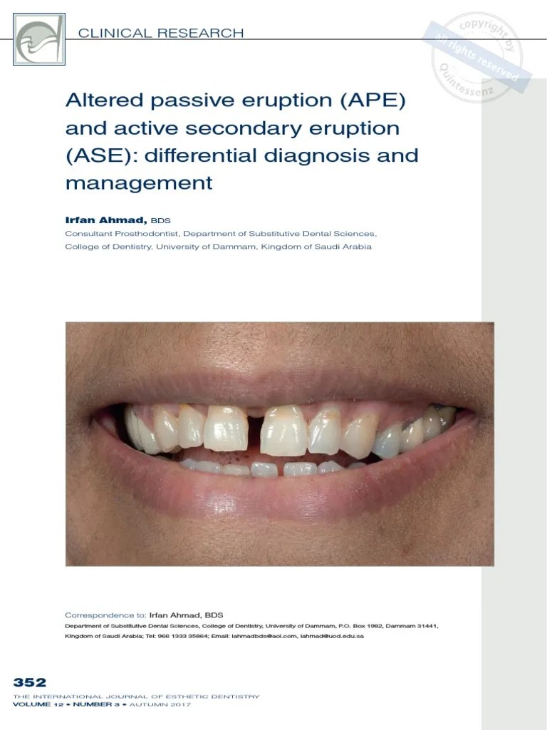 Altered Passive Eruption and Active Secondary Eruption PDF