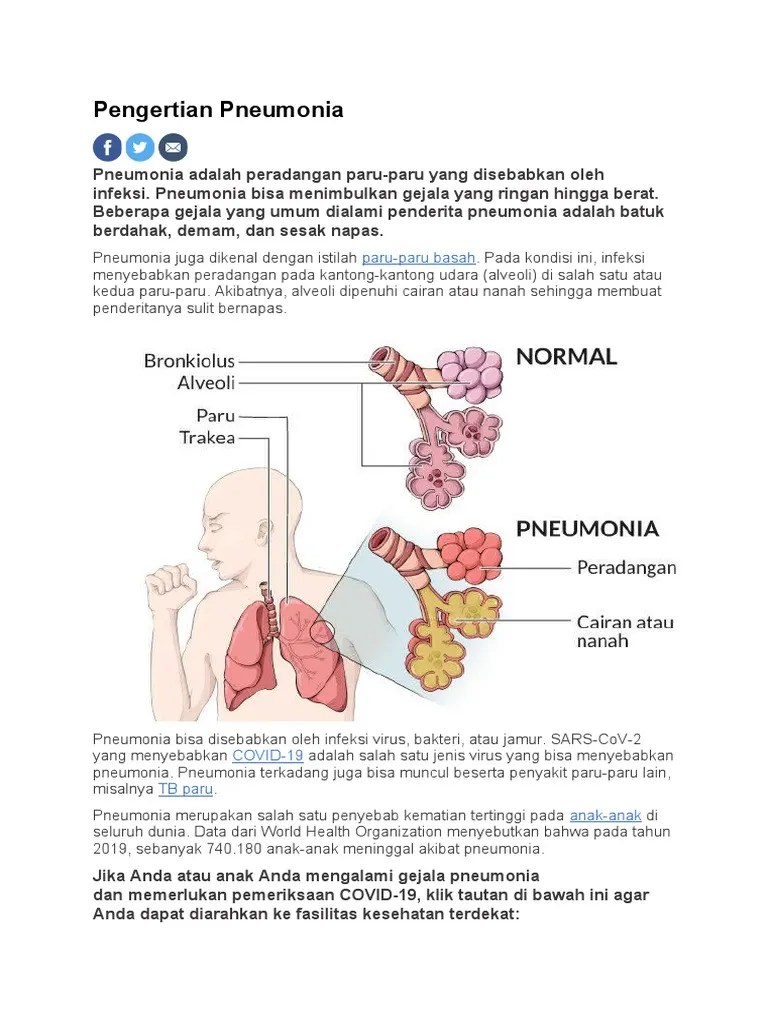 Pengertian Pneumonia Dalam Dunia Kesehatan