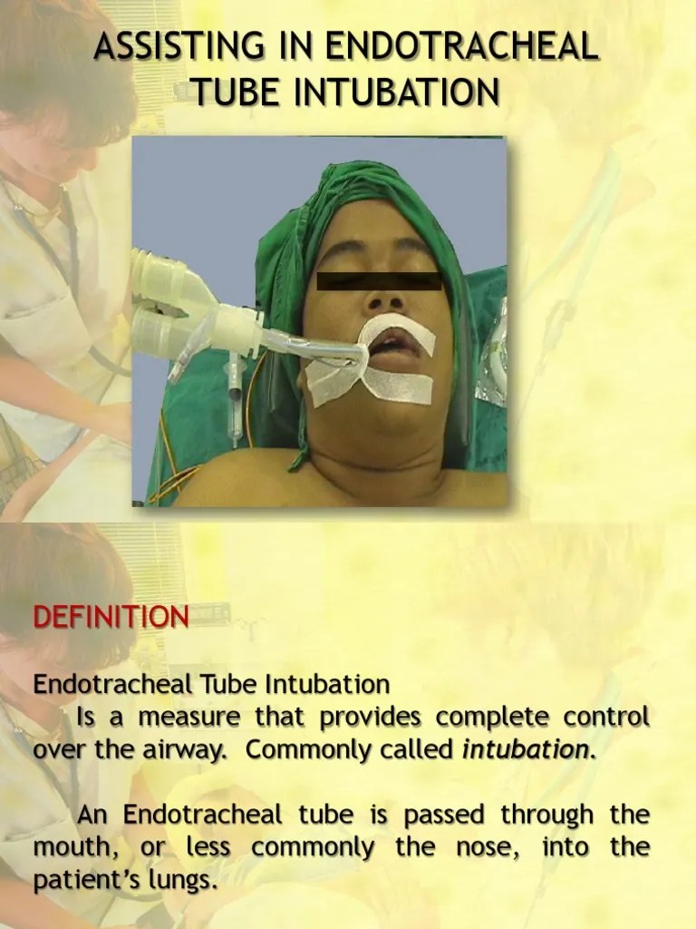 Assisting in Endotracheal Intubation1 PDF