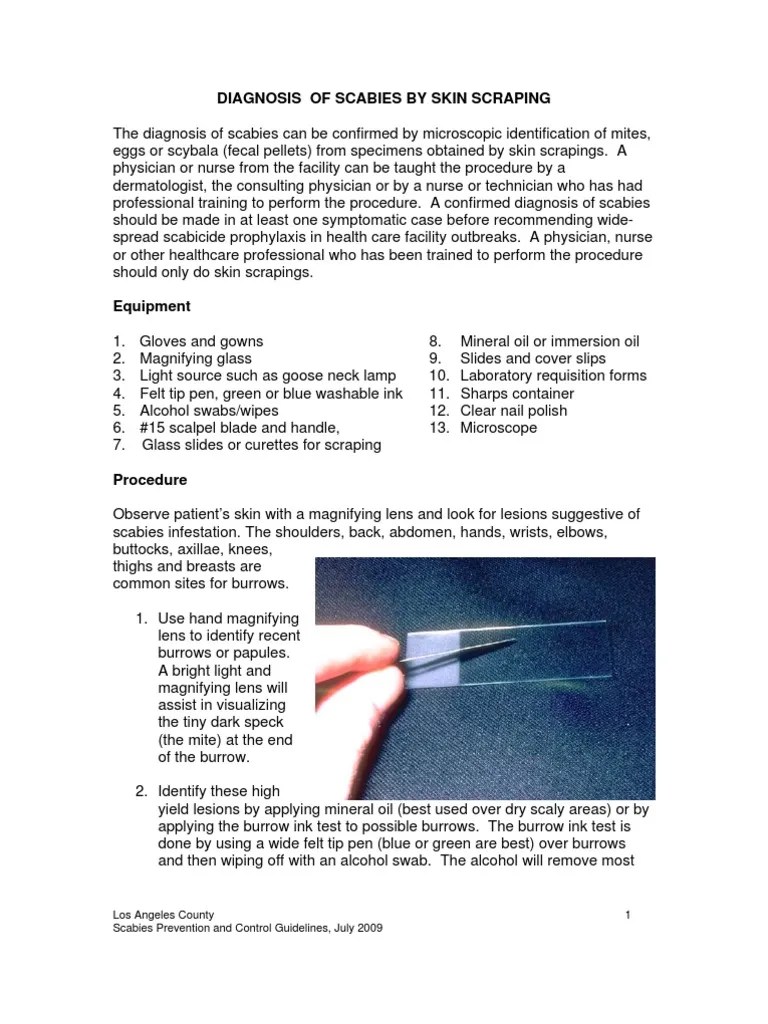 Skin Scraping Procedure Clinical Medicine Medical Specialties