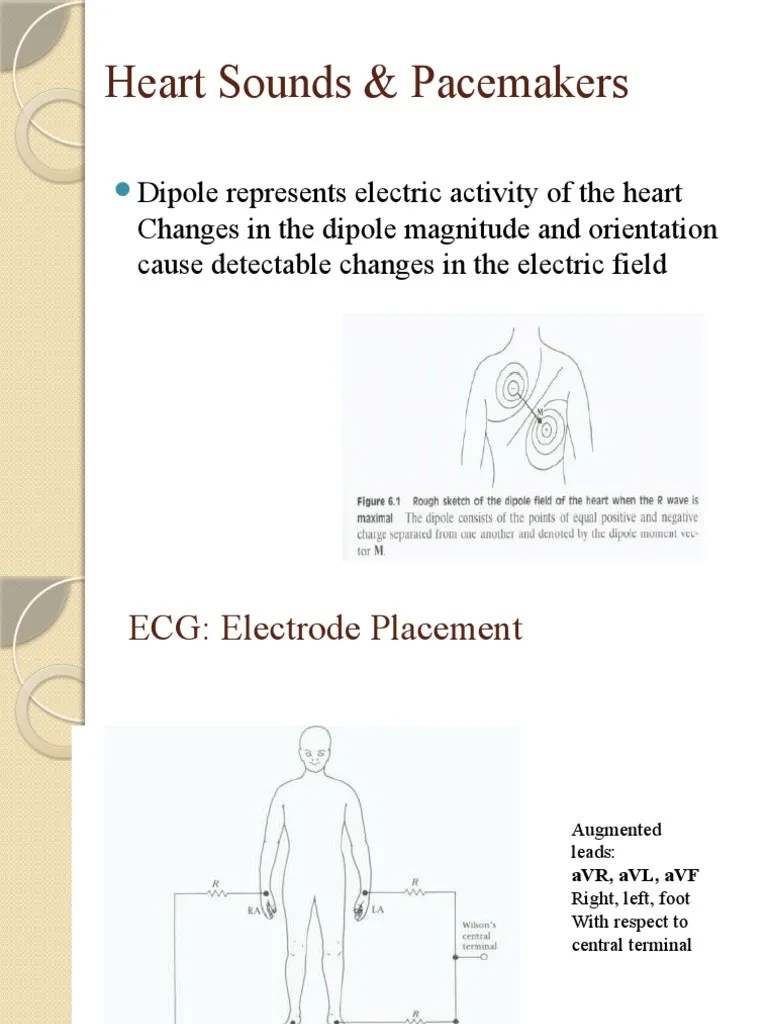 6heart Sound Pacemaker PDF Heart Electrocardiography