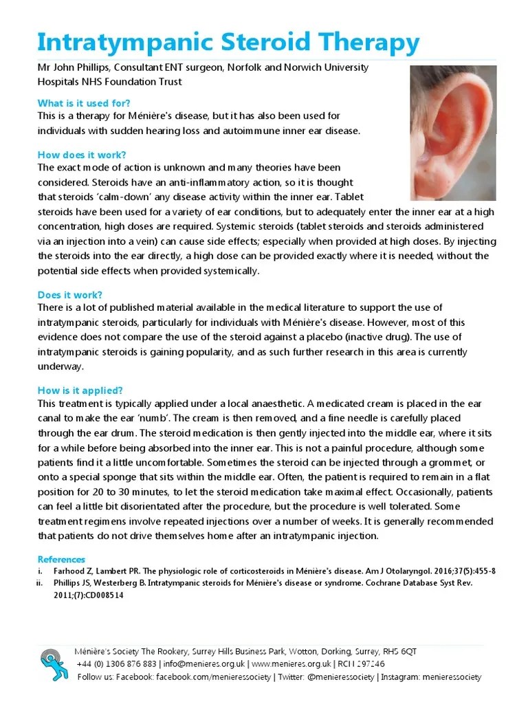 Intratympanic Steroid Therapy PDF Ménière's Disease Ear
