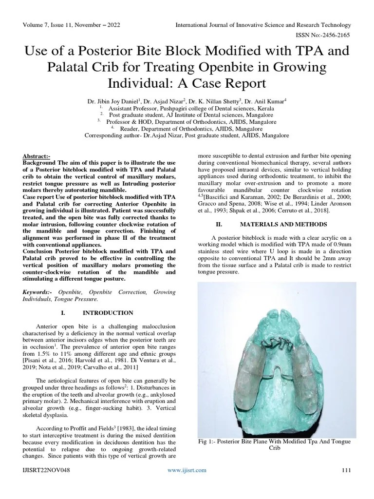 Use of A Posterior Bite Block Modified With TPA and Palatal Crib For