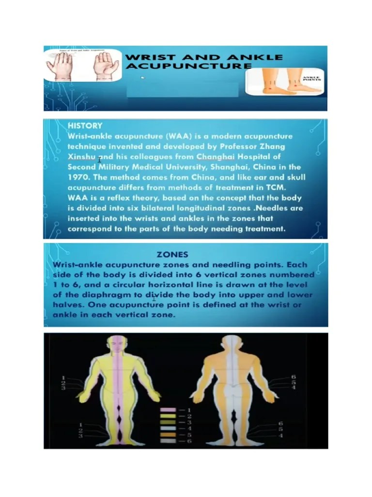 WristAnkle Acupuncture A Guide to Needling the Wrist and Ankle Points According to the Six
