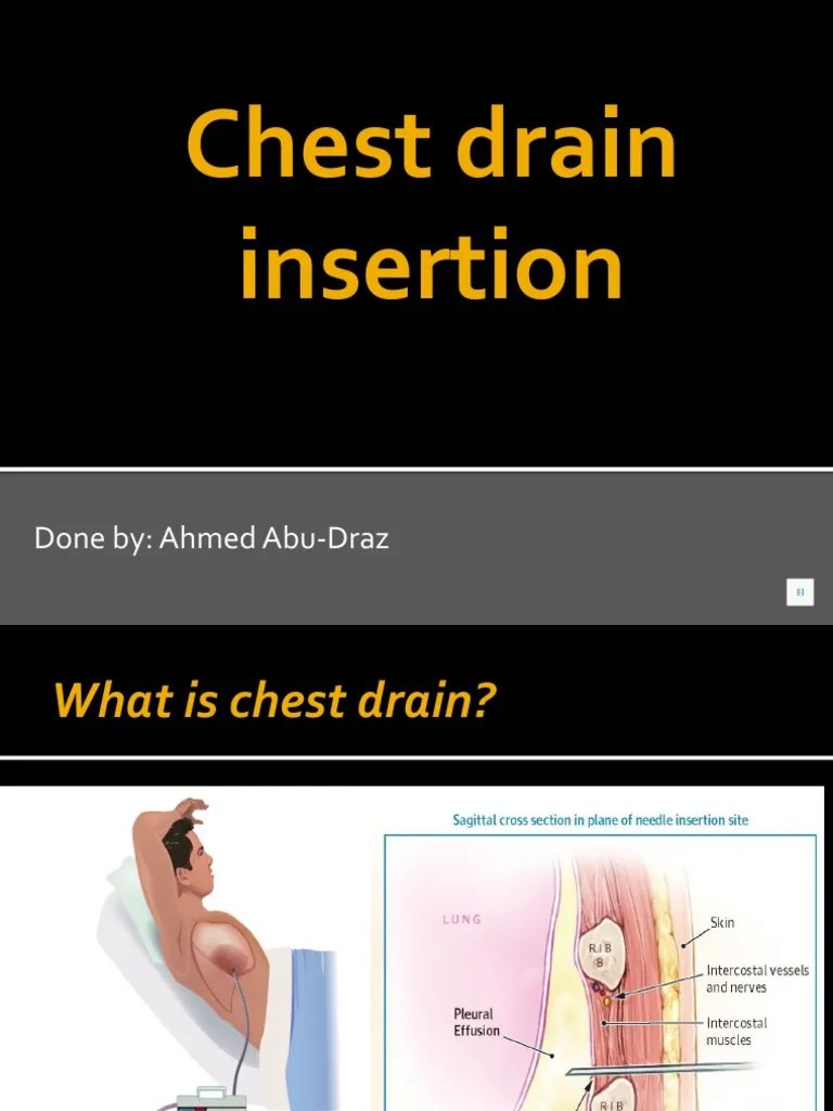 Chest Drain Insertion1 PDF Thorax Clinical Medicine