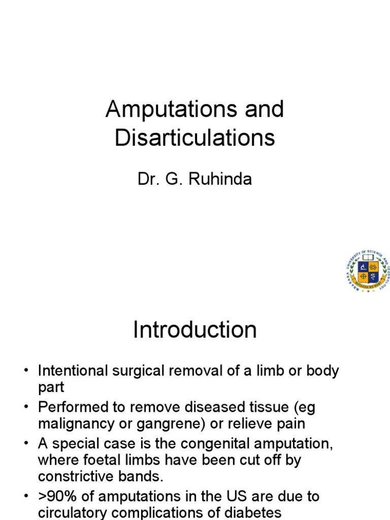 An Overview of Amputations Indications, Types, Rehabilitation and Complications PDF