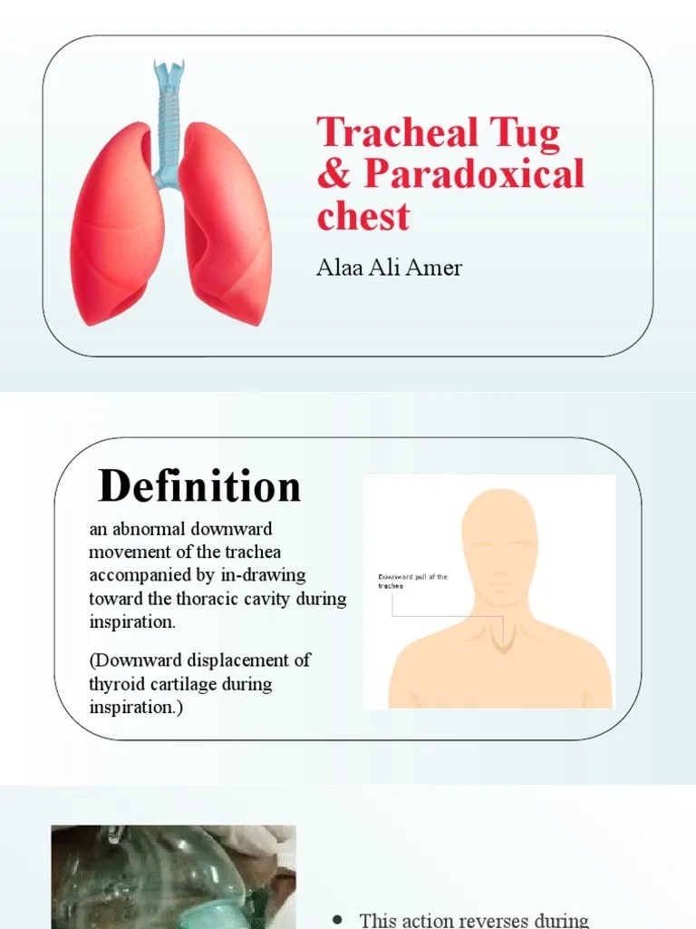 Tracheal Tug Paradoxical Chest Movement PDF
