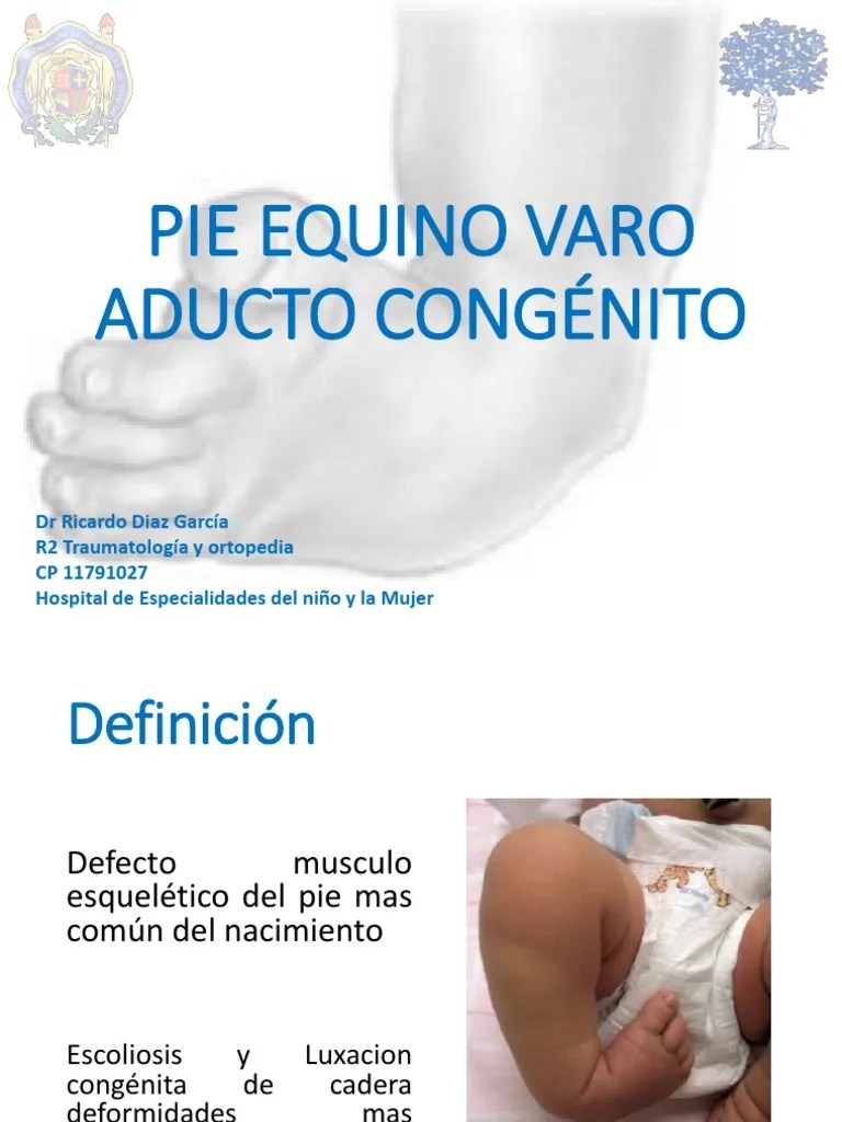 PIE EQUINO VARO ADUCTO CONGÉNITO.pdf PDF