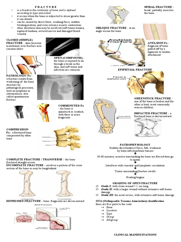 Is A Break in The Continuity of Bone and Is Defined According To Type and Extent PDF Anatomy