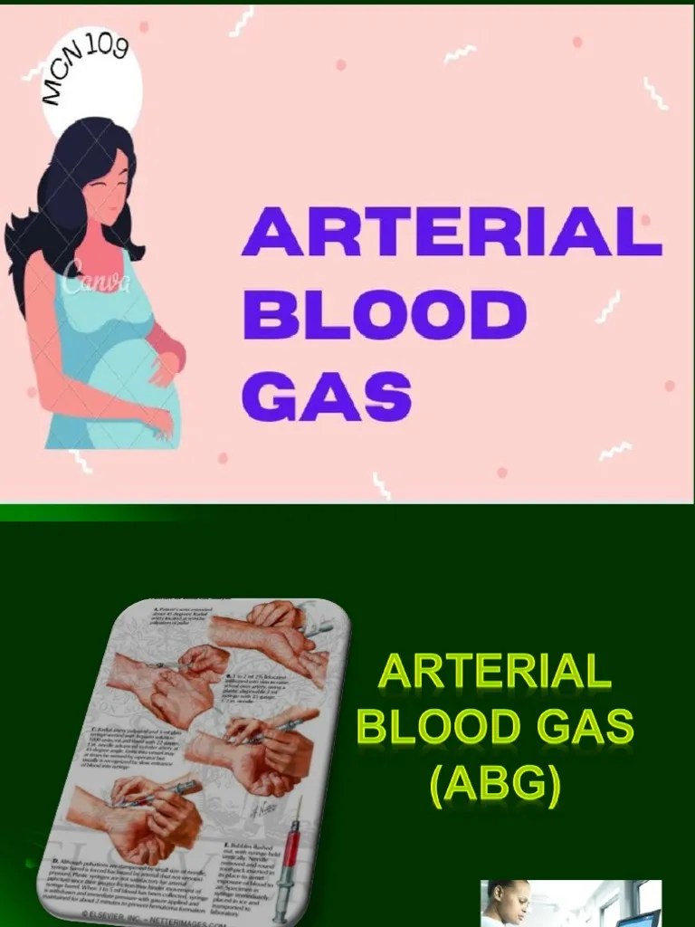 NCM 109 Skills Lab Day 13.1 Arterial Blood Gas Abg22 PDF Breathing