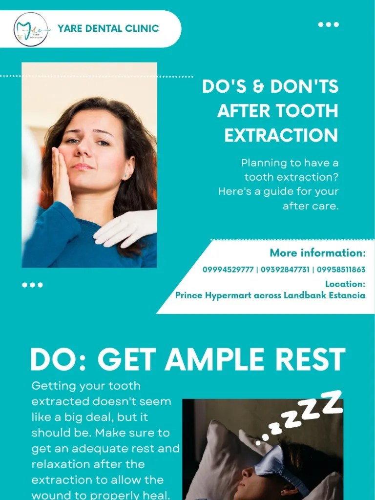 Do's and Don'ts After Tooth Extraction PDF