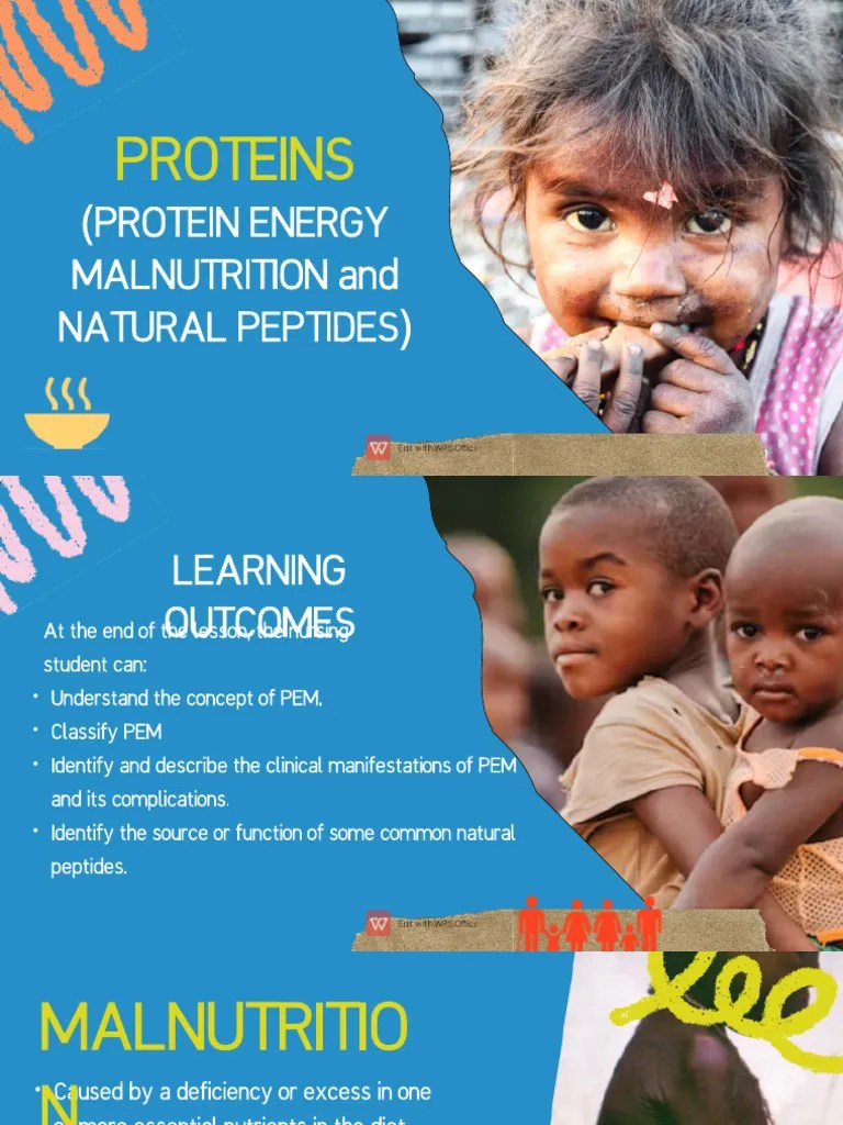 Share PROTEINS (PROTEIN ENERGY MALNUTRITION and NATURAL PEPTIDES) PDF