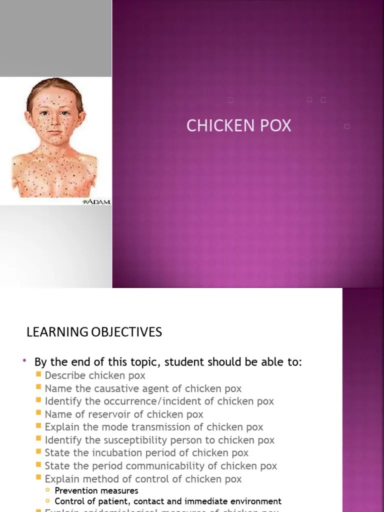 Chickenpox PDF Smallpox Health Sciences