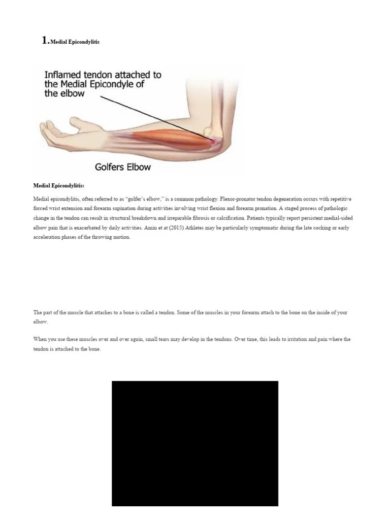 Medial Epicondylitis PDF Elbow Anatomical Terms Of Motion