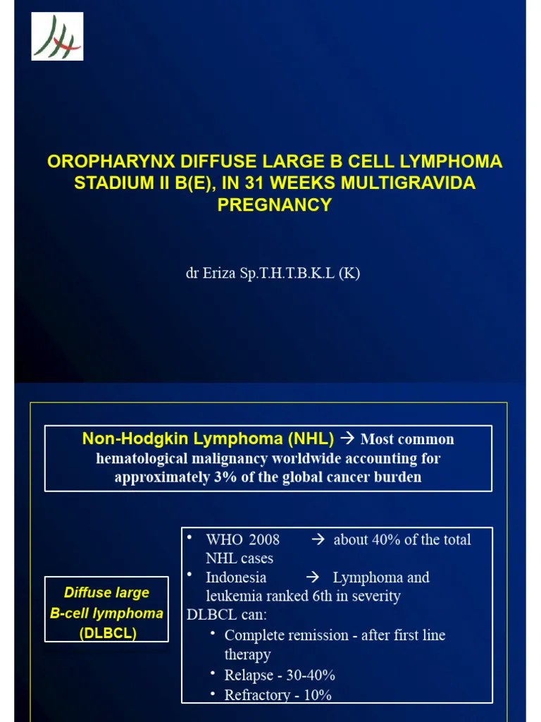 Oropharynx Diffuse Large B Cell Lymphoma Stadium II B (E), in 31 Weeks