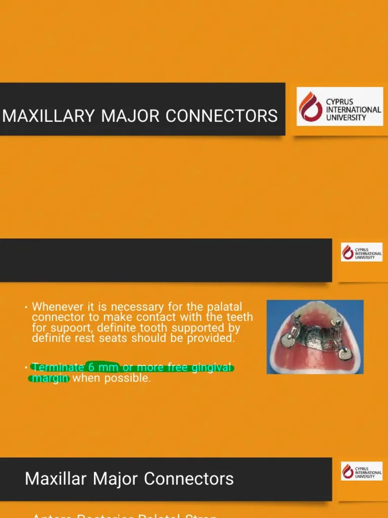 Maxillary Major Connectors PDF Anatomical Terms Of Location Dentures