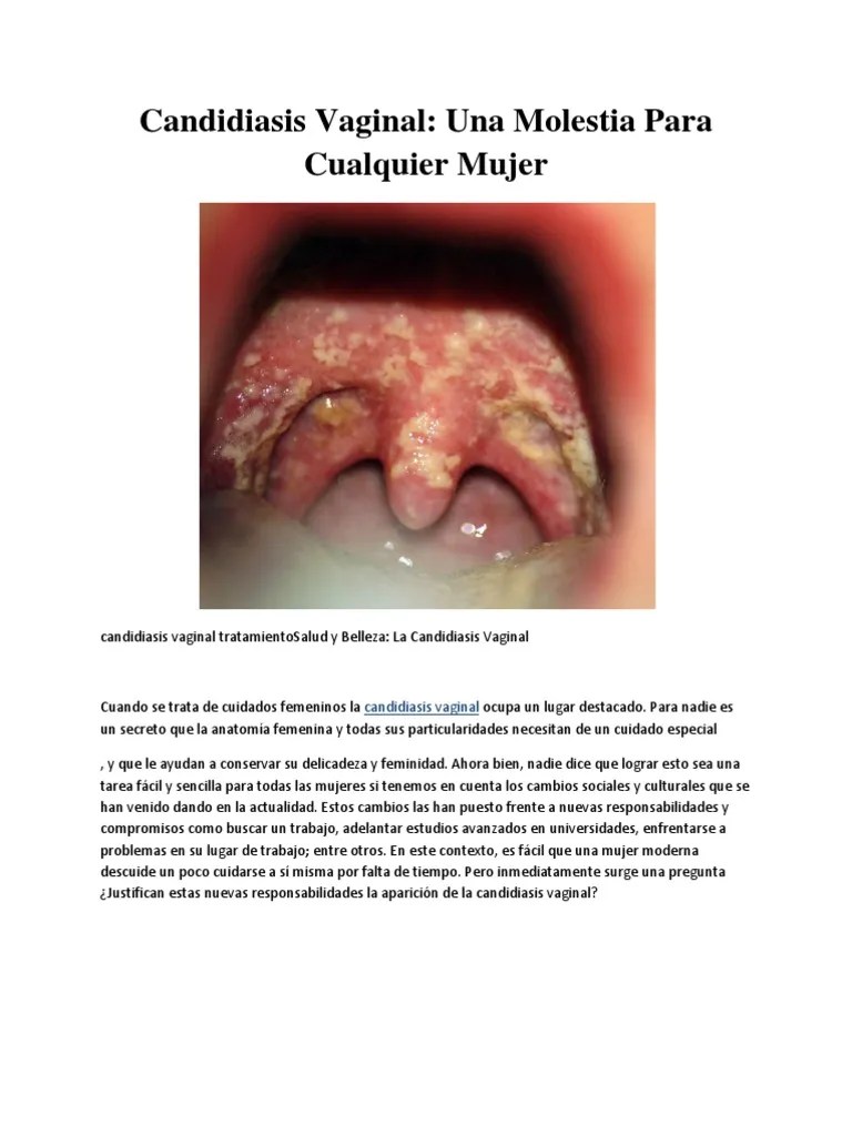 Candidiasis Vaginal Candidiasis Vagina