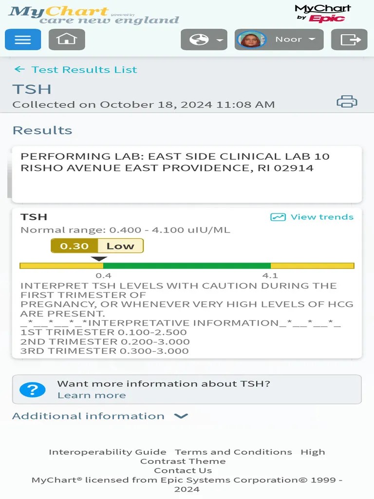 TSH Test Results and Interpretation PDF