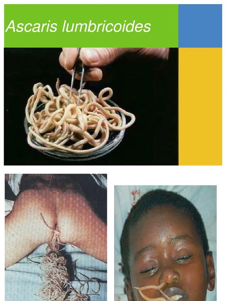 Ascaris Lumbricoides Health Sciences Wellness