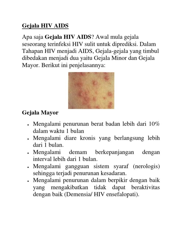 Gejala Hiv Aids | PDF