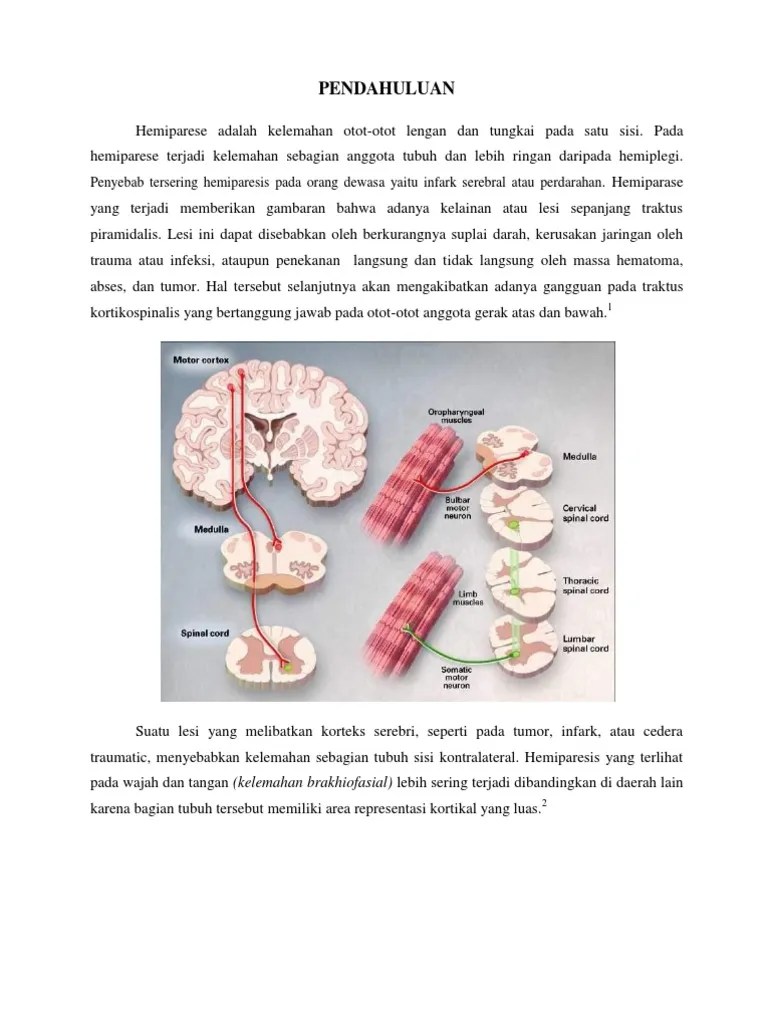 Hemiparesis | PDF