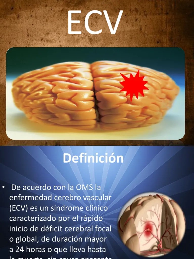 ECV Isquemia Angiología