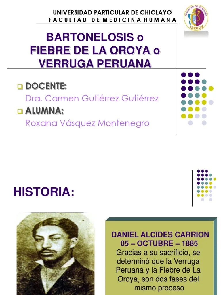 BARTONELOSIS PDF Patologia clinica Enfermedades y trastornos