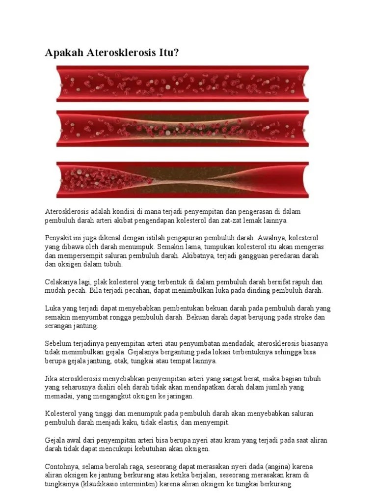 Apakah Aterosklerosis Itu | PDF